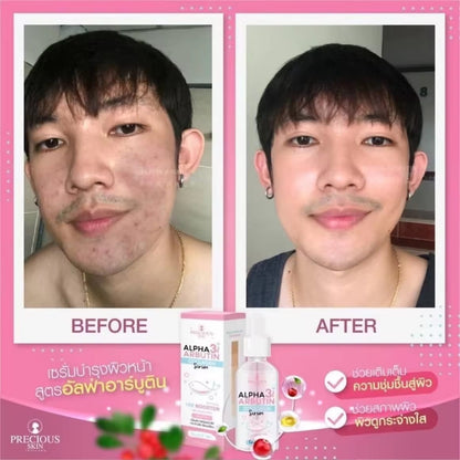 Precious Skin Alpha Arbutin 3+ Plus Collagen Whitening Facial Serum 50ml