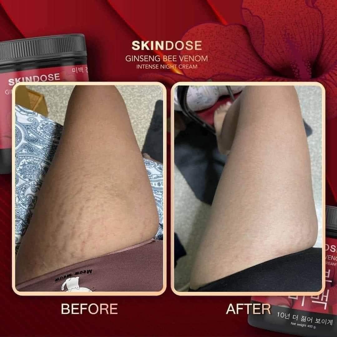 SkinDose Ginseng Bee Venom Intense Night Cream 400ml